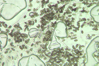 mold under a microscope